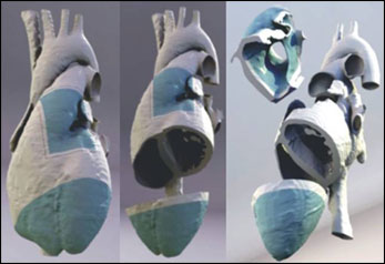 Cardiac imaging data in to high-quality 3D models